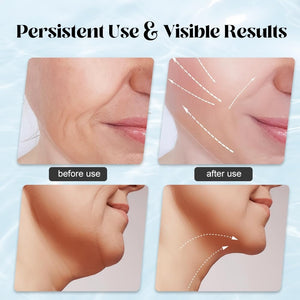 EMS Face Lifting Massager with Red Light Therapy | Facial, Neck & Eye Microcurrent Vibrating Massage Tool Elite Vibe