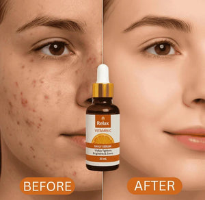 Relax Vitamin C Daily Serum - 30ml | Visibly Brightens, Evens Skin Tone Elite Vibe