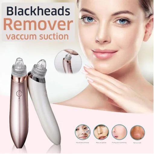 Blackhead Remover Facial Cleaner Elite Vibe