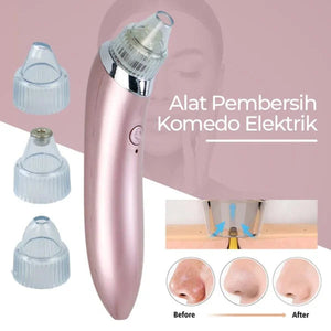 Blackhead Remover Facial Cleaner Elite Vibe