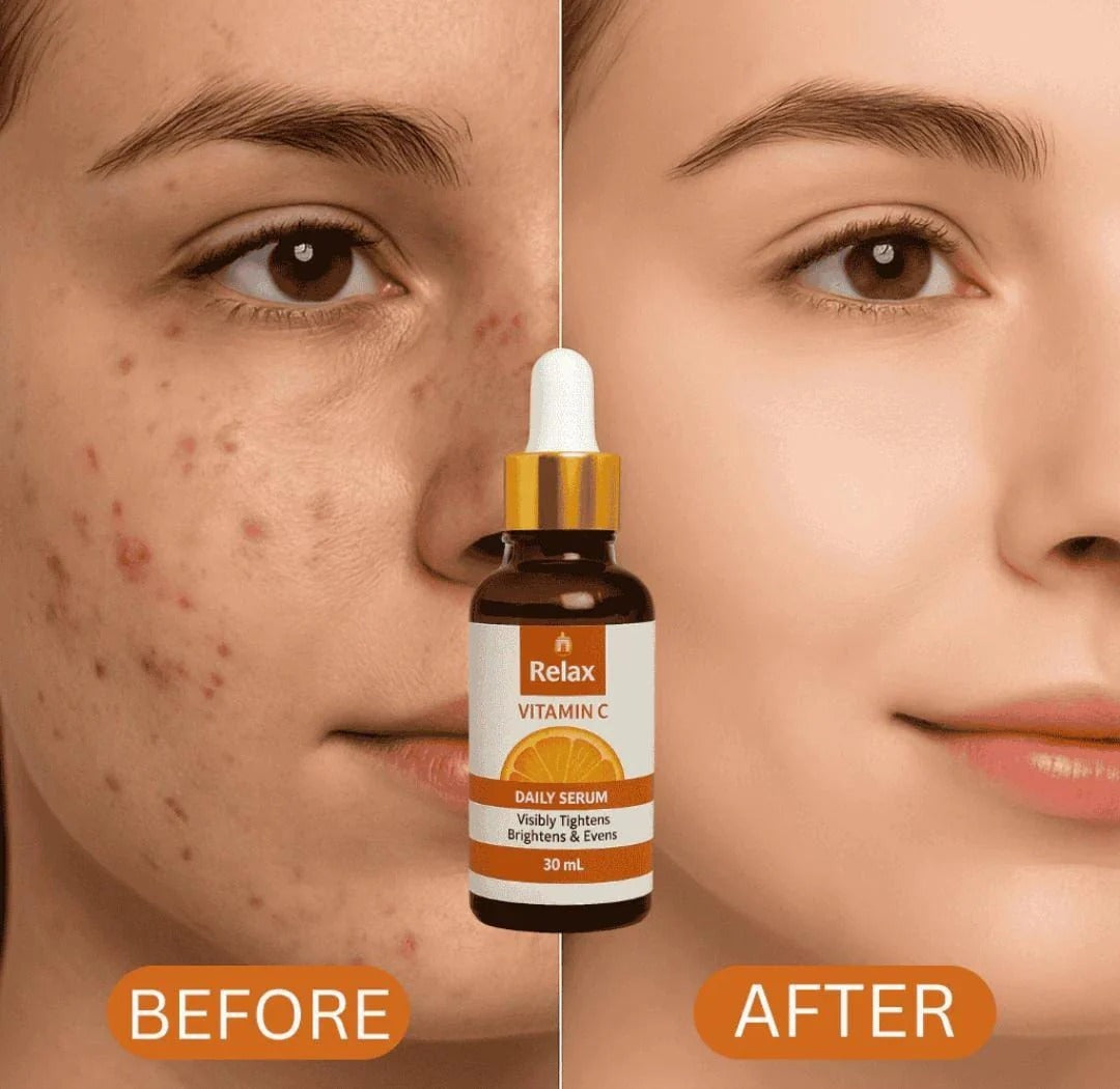 Relax Vitamin C Daily Serum - 30ml | Visibly Brightens, Evens Skin Tone Elite Vibe